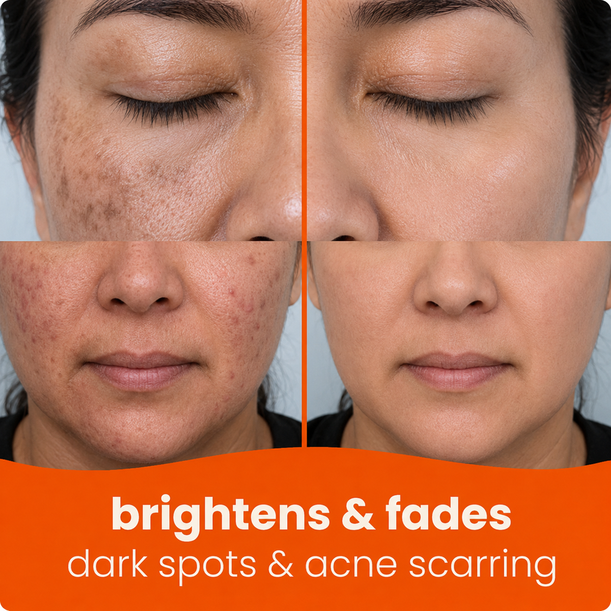Prionne™ Turmeric + Kojic Acid Cleansing Pads