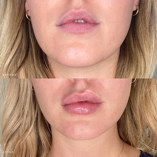 NESLEMY ✨Hydrating Collagen Mouth Tape👄