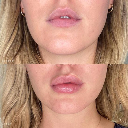 NESLEMY ✨Hydrating Collagen Mouth Tape👄